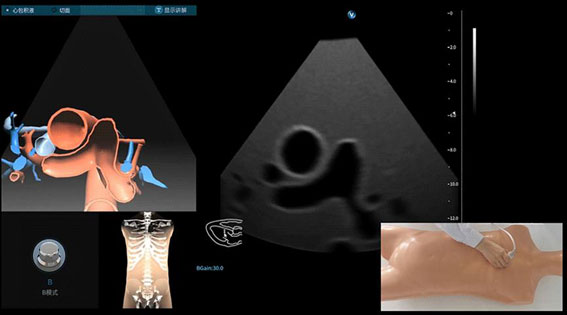 超聲模擬實訓(xùn)系統(tǒng) 單機版（女）